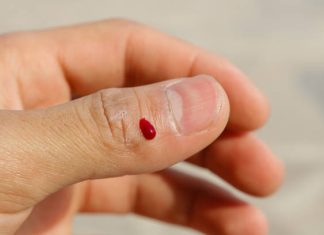 Diabetic Wound Care: Why Proper Treatment is Critical and How to Care at Home diabetic wound care treatment prevention