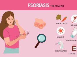 How to Cure Psoriasis Permanently How to Cure Psoriasis Permanently