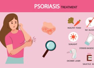 How to Cure Psoriasis Permanently How to Cure Psoriasis Permanently