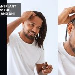 Afro Hair Transplant in Turkey: What Makes Curly Hair Different and What to Expect afro hair transplant in Turkey