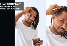 Afro Hair Transplant in Turkey: What Makes Curly Hair Different and What to Expect afro hair transplant in Turkey