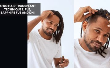 Afro Hair Transplant in Turkey: What Makes Curly Hair Different and What to Expect afro hair transplant in Turkey